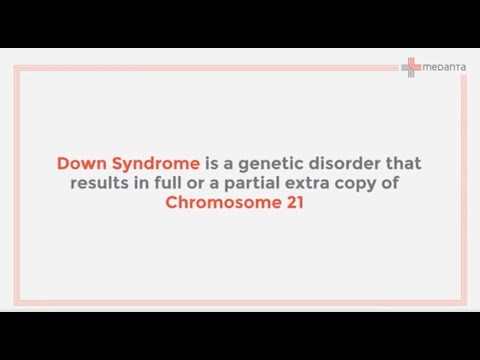 Down Syndrome